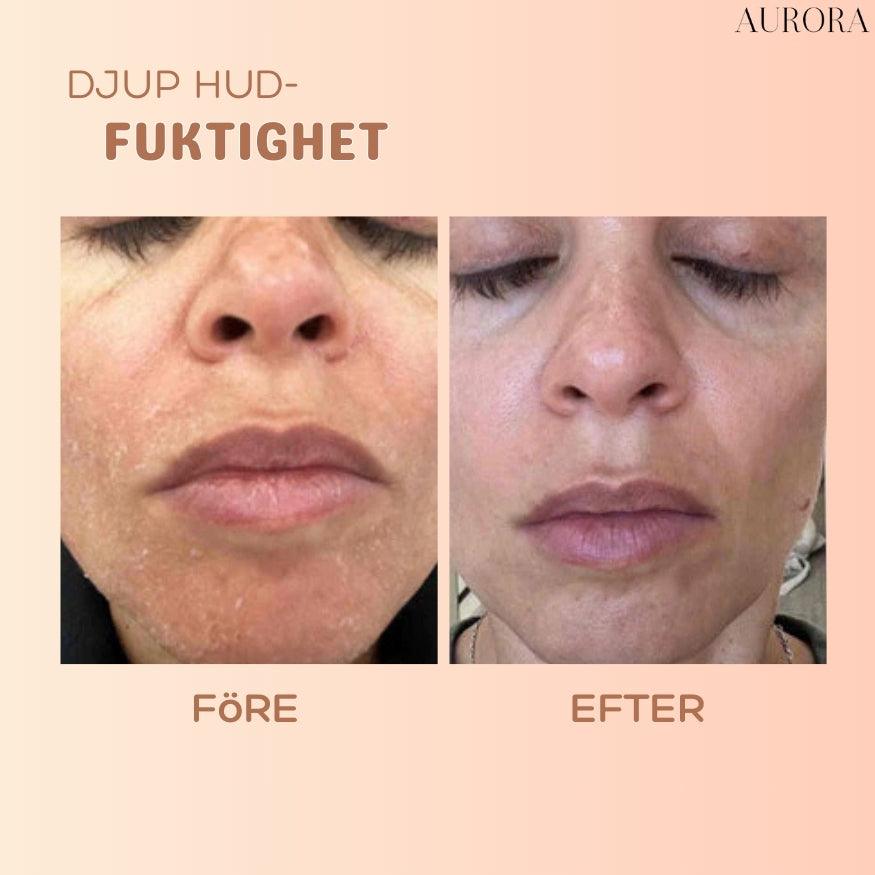 1+1 GRATIS SISTA DAGEN | MultiBalm⹠- hudförnyande stift mot rynkor - Aurora Stockholm