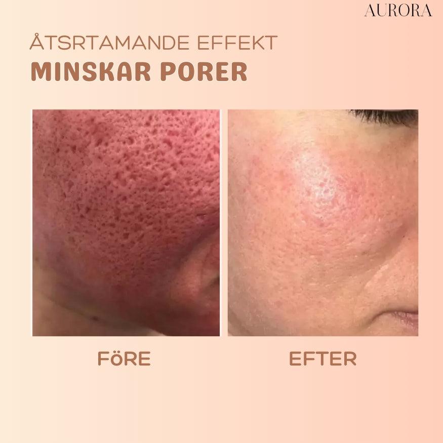 1+1 GRATIS SISTA DAGEN | MultiBalm⹠- hudförnyande stift mot rynkor - Aurora Stockholm