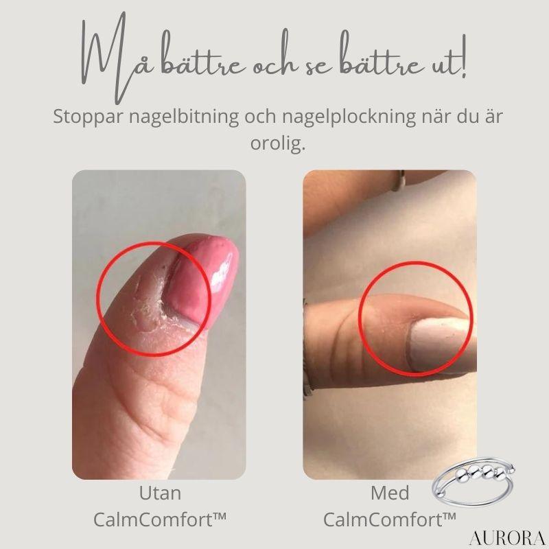 CalmComfortâą - Justerbar pĂ€rl-ring | 1+1 GRATIS TILLFĂLLIGT - Aurora Stockholm