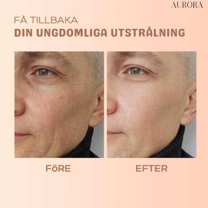 1+1 GRATIS SISTA DAGEN | MultiBalm⹠- hudförnyande stift mot rynkor - Aurora Stockholm