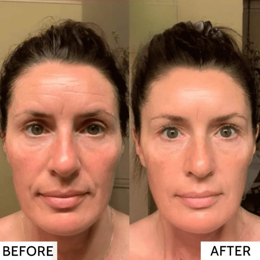 TILLFĂLLIGT 50% RABATT | RevitaMaskâą | Hudkollagenmask