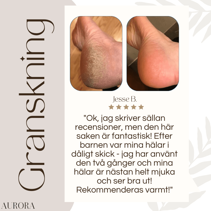 CallusMaster⹠- Electric Callus Master | 50% tillfÀllig rabatt - Aurora Stockholm