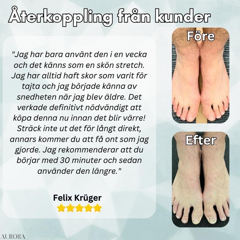OrthoAlignâą â Korrigerare för snea tĂ„r | BEGRĂNSAD 50%-75% RABATT - Aurora Stockholm