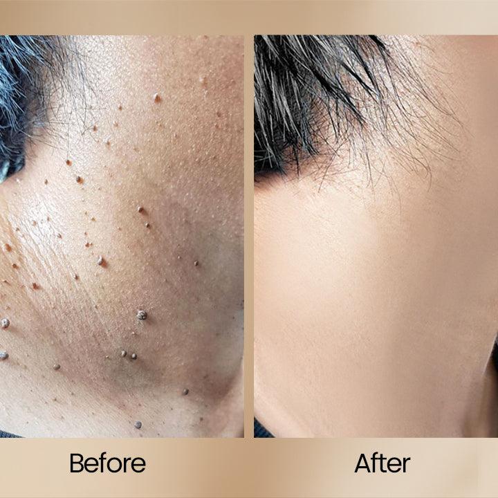ClearSkinâą | Bienegift Vortborttagningsspray - Aurora Stockholm