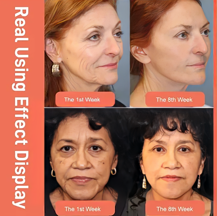 1 + 1 GRATIS IDAG | FirmGlow⹠| Retinol Drakblod Anti-rynkkrÀm