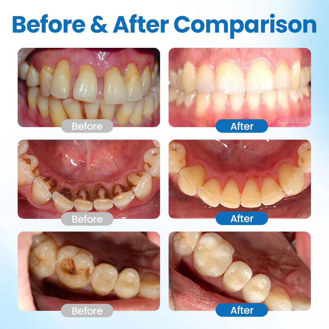 1 + 1 GRATIS IDAG | ToothArmor™
