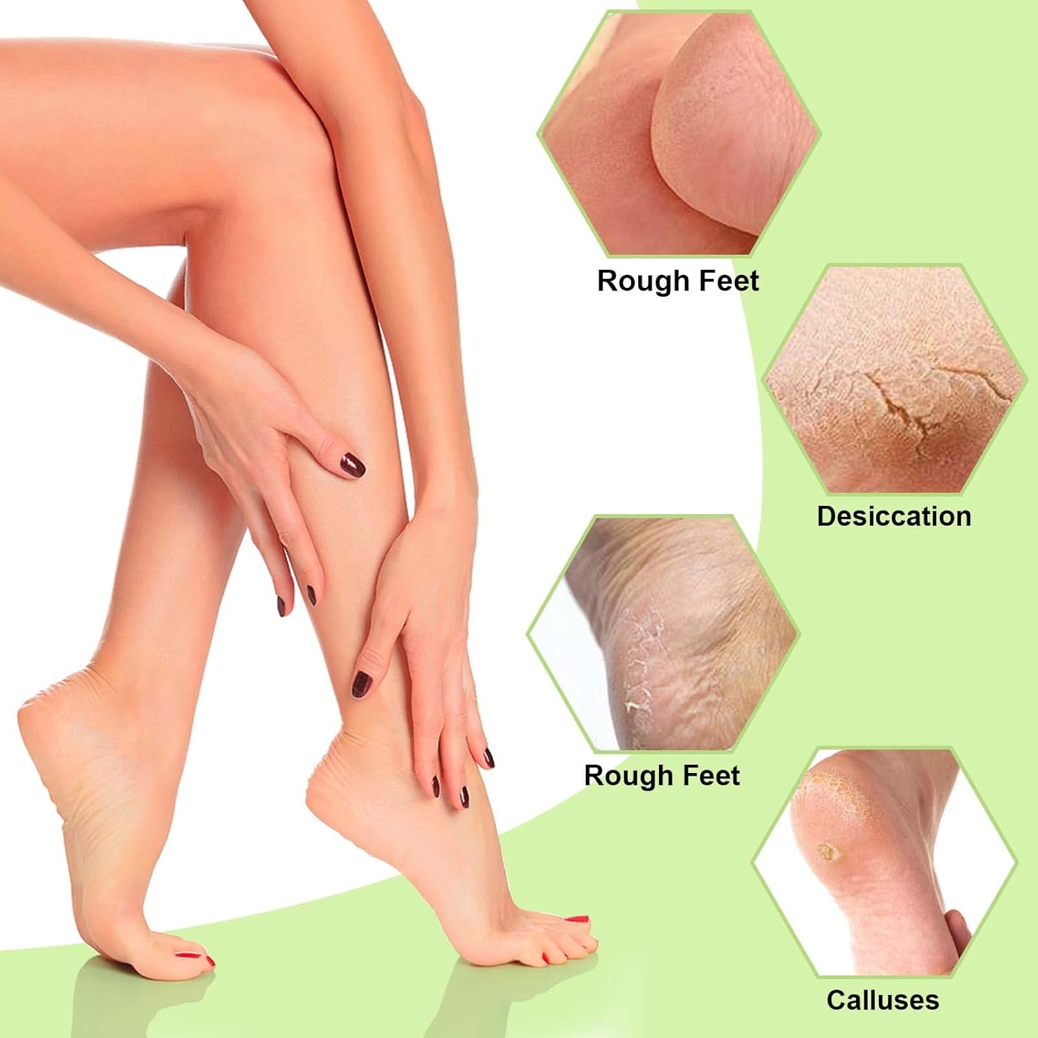HydraFeet⹠| SÀg adjö till spruckna hÀlar!