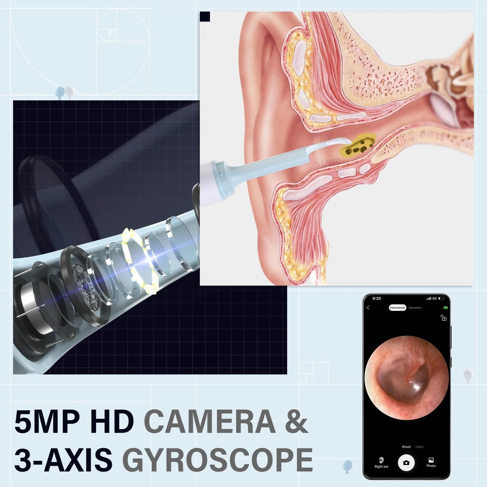 EarClear⹠| Enkel borttagning av öronvax med visualiseringar i realtid!