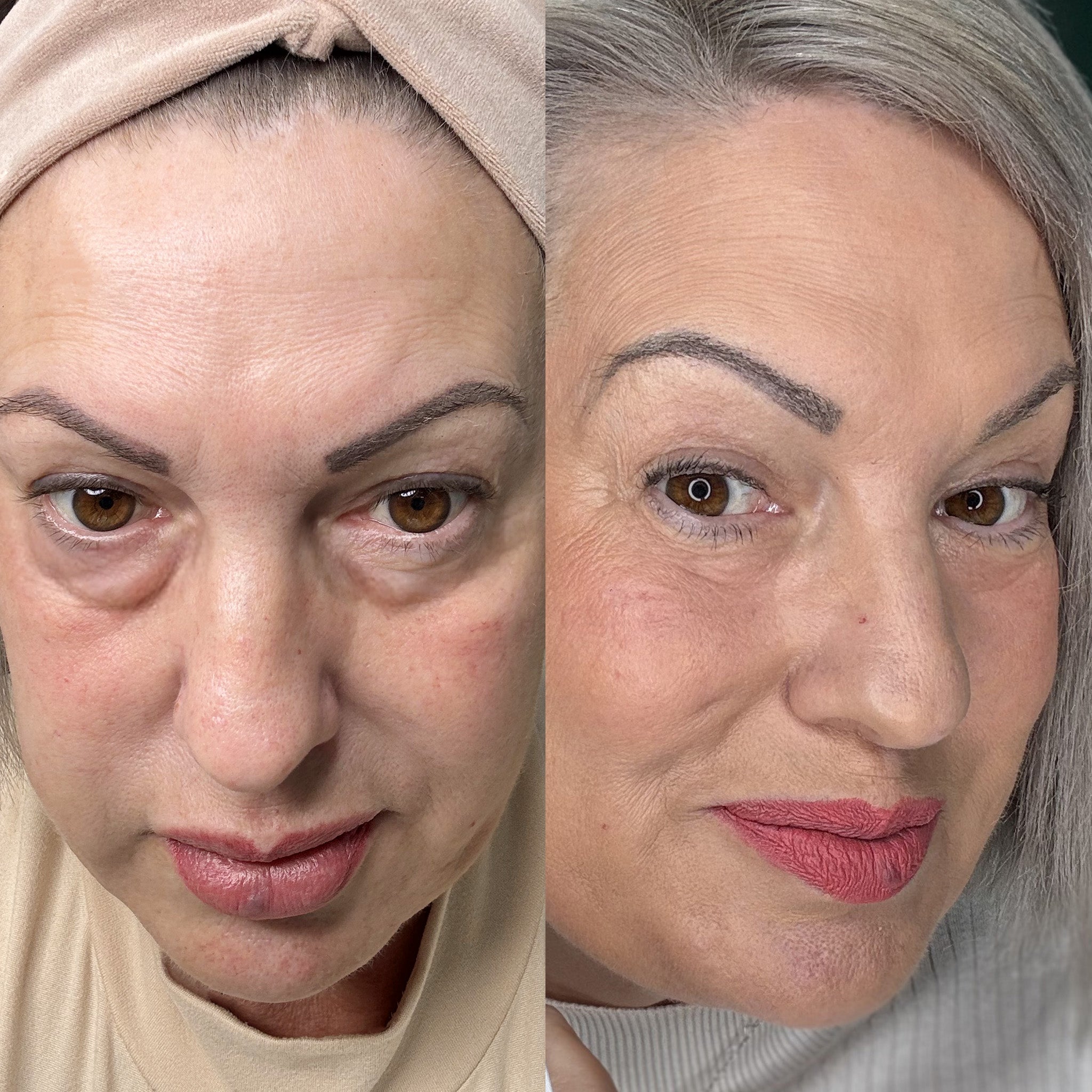 EyeRevive™ | Säg adjö till mörka ringar och svullnader!