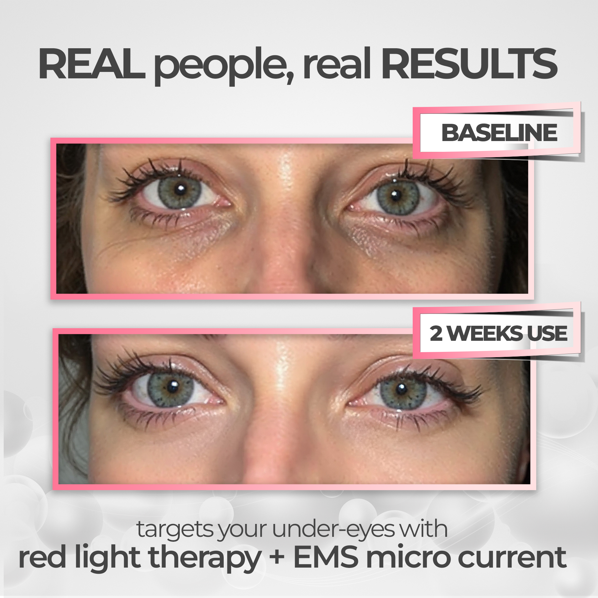 EyeRevive™ | Säg adjö till mörka ringar och svullnader!
