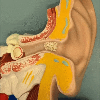 TILLFÄLLIGT 50% OFF  EarVac™