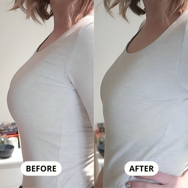 SlimFit™ | En behå som på ett skonsamt sätt minimerar dina bröst!