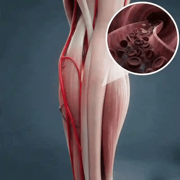 TILLFÄLLIGT 50% OFF  CircuCare™