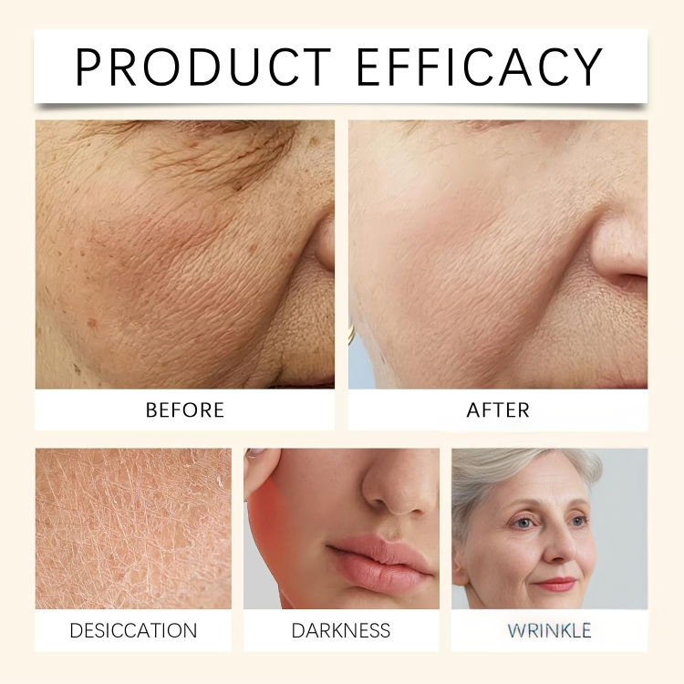 TILLFÄLLIGT 50% RABATT | NouriSkin™ | Avslöja hemligheten bakom silkeslen hud från topp till tå!