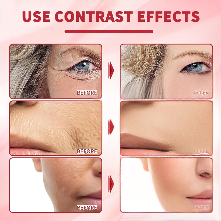 1 + 1 GRATIS IDAG | FirmGlow™ | Retinol Drakblod Anti-rynkkräm