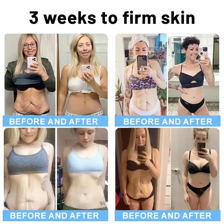 1 + 1 GRATIS IDAG | RevitaStick™ | Din hemlighet för en fastare och mer elastisk hud!