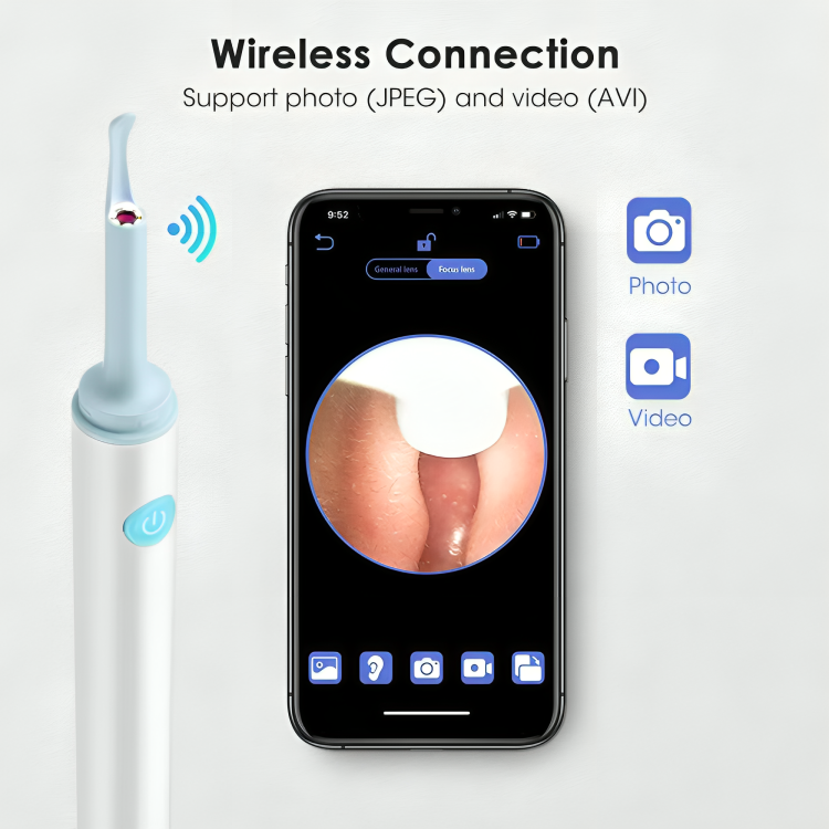 EarClear™ | Enkel borttagning av öronvax med visualiseringar i realtid!
