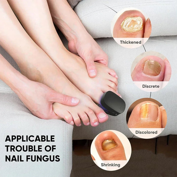 TILLFÄLLIGT 50% OFF  NailCure™