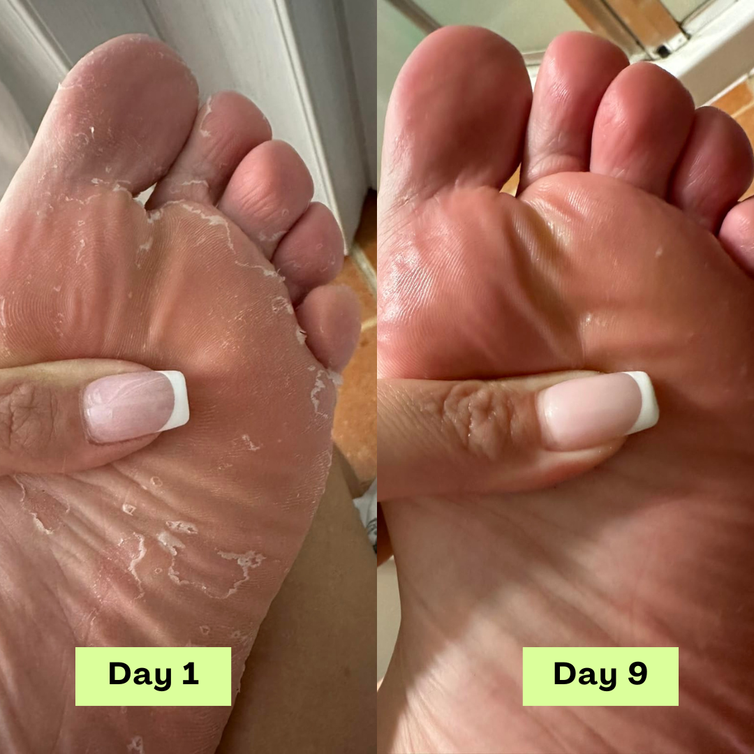 1 + 2 GRATIS IDAG | DermaCure™