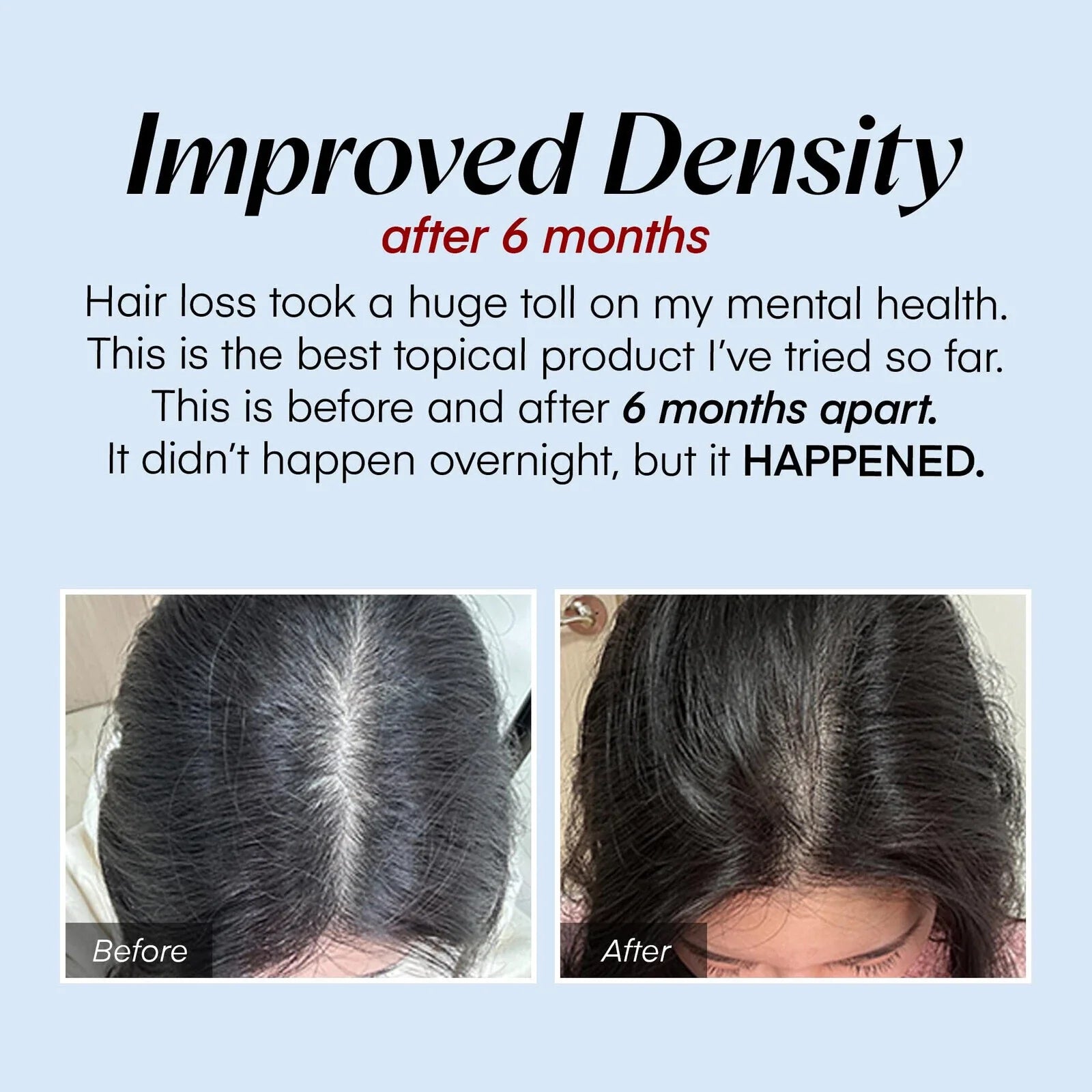 TILLFÄLLIGT 50% RABATT | HairVive™ | Upplev kraften i omedelbar reparation och näring för håret!