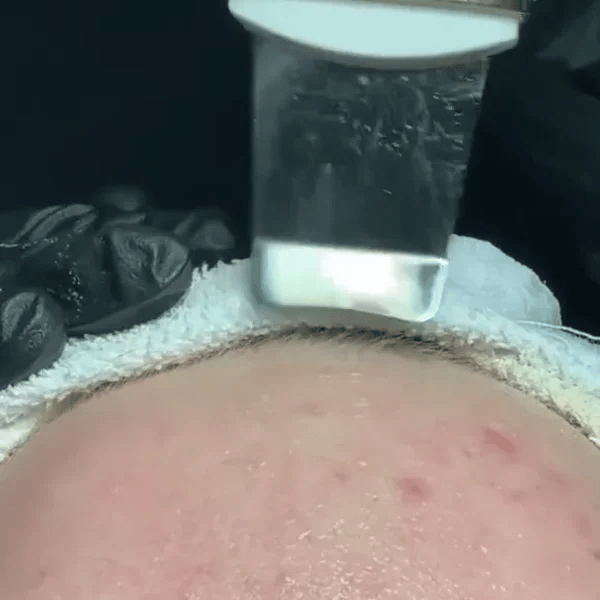TILLFÄLLIGT 50% OFF  SkinSonic™